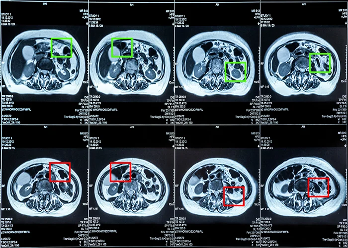AI powered medical imaging